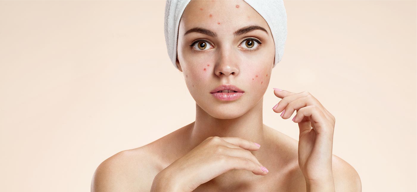 Как добиться чистой кожи: 8 простых шагов